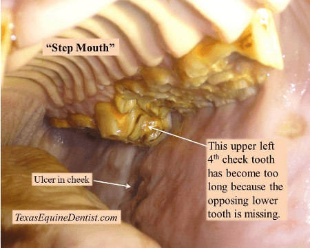 Step Mouth